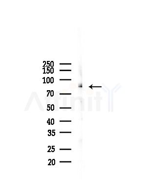 COPG Antibody - Western blot analysis of lysates from Hela cells(heat-shock, 45min treatment), using COPG Antibody at 1/1000 dilution.