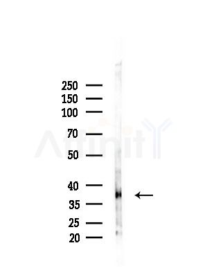 CCDC109A Antibody - Western blot analysis of lysates from PC12 cells(LPS, 4h treatment), using CCDC109A Antibody at 1/1000 dilution.