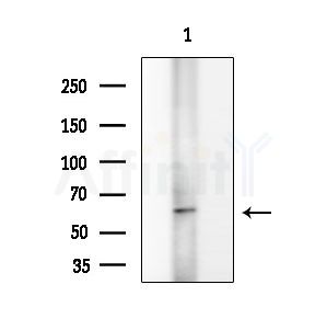 CCDC8 Antibody - Western blot analysis of extracts from Rat testis, using CCDC8 Antibody at 1/1000 dilution.