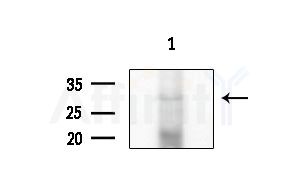 C1QTNF8 Antibody - Western blot analysis of extracts from HepG2 cells(LPS 4h treatment), using C1QTNF8 Antibody at 1/1000 dilution.