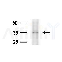 C1QTNF9B Antibody - Western blot analysis of extracts from various samples, using C1QTNF9B Antibody at 1/1000 dilution.