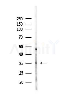 C1QTNF9B Antibody - Western blot analysis of lysates from HepG2 cells(LPS, 4h treatment), using C1QTNF9B Antibody at 1/1000 dilution.