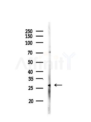 C1QL3 Antibody - Western blot analysis of lysates from COLO205 cells(heat-shock,45min treatment), using C1QL3 Antibody at 1/1000 dilution.