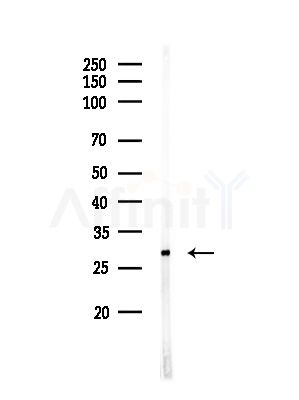 C1QL3 Antibody - Western blot analysis of lysates from Hela cells(starvation,24h treatment), using C1QL3 Antibody at 1/1000 dilution.