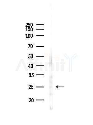 C1QL4 Antibody - Western blot analysis of lysates from PC12 cells, using C1QL4 Antibody at 1/1000 dilution.