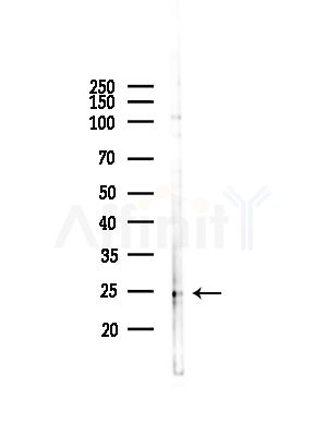 C1QL4 Antibody - Western blot analysis of lysates from Hela cells(heat-shock,45min treatment), using C1QL4 Antibody at 1/1000 dilution.