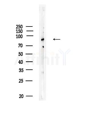 C7 Antibody - Western blot analysis of lysates from HUVEC cells, using C7 Antibody at 1/1000 dilution.