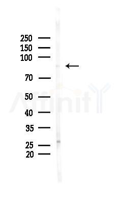 PLA2G4B Antibody - Western blot analysis of lysates from Rat brain, using PLA2G4B Antibody at 1/1000 dilution.