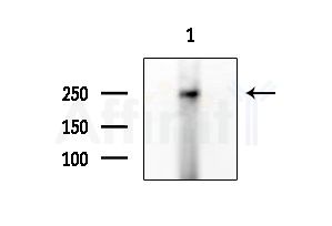 DOCK7 Antibody - Western blot analysis of extracts from EC304 cells, using DOCK7 Antibody at 1/1000 dilution.
