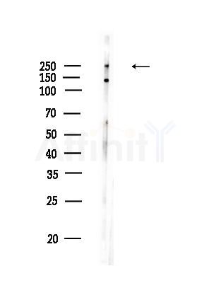 DOCK7 Antibody - Western blot analysis of lysates from EC304 cells, using DOCK7 Antibody at 1/1000 dilution.