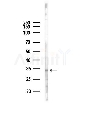 DHRS1 Antibody - Western blot analysis of lysates from PC12 cells, using DHRS1 Antibody at 1/1000 dilution.