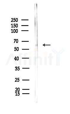 DCLRE1B Antibody - Western blot analysis of lysates from Hela cells(heat-shock,45min treatment), using DCLRE1B Antibody at 1/1000 dilution.