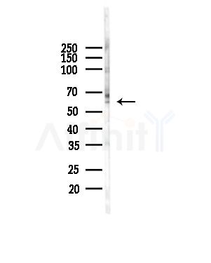 POLE2 Antibody - Western blot analysis of lysates from COLO205 cells(heat-shock,45min treatment), using POLE2 Antibody at 1/1000 dilution.