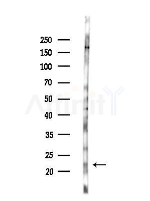 GINS2 Antibody - Western blot analysis of lysates from B16F10-LUC cells(LPS,4h treatment), using GINS2 Antibody at 1/1000 dilution.