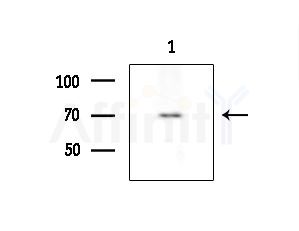 TOP1MT Antibody - Western blot analysis of extracts from EC304 cells
(heat-shock treatment), using TOP1MT Antibody at 1/1000 dilution.