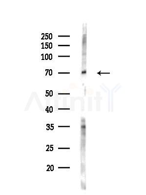 TOP1MT Antibody - Western blot analysis of lysates from EC304 cells(heat-shock treatment), using TOP1MT Antibody at 1/1000 dilution.