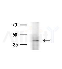 TWISTNB Antibody - Western blot analysis of lysates from various samples, using TWISTNB Antibody at 1/1000 dilution.