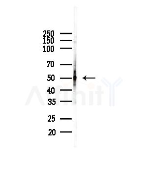 RPA49 Antibody - Western blot analysis of lysates from COLO205 cells(heat-shock,45min treatment), using RPA49 Antibody at 1/1000 dilution.