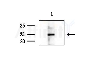 RPC7 Antibody - Western blot analysis of extracts from Rat liver, using RPC7 Antibody at 1/1000 dilution.