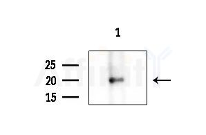 RPC9 Antibody - Western blot analysis of extracts from B16F10-LUC cells
(LPS 4h treatment), using RPC9 Antibody at 1/1000 dilution.