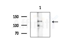 POLRMT Antibody - Western blot analysis of extracts from EC304 cells
(heat-shock treatment), using POLRMT Antibody at 1/1000 dilution.