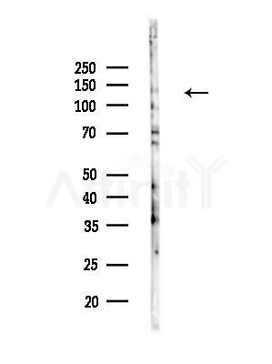 POLRMT Antibody - Western blot analysis of lysates from EC304 cells(heat-shock treatment), using POLRMT Antibody at 1/1000 dilution.