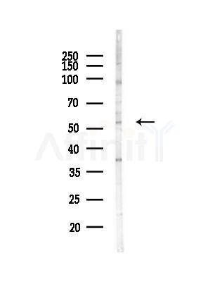 DCTN4 Antibody - Western blot analysis of lysates from HepG2 cells(heat-shock,45min treatment), using DCTN4 Antibody at 1/1000 dilution.