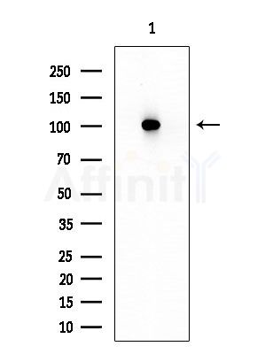 HACE1 Antibody - Western blot analysis of extracts from HUVEC cells, using HACE1 Antibody at 1/1000 dilution.