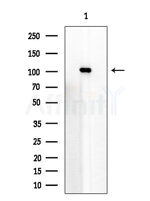 HACE1 Antibody - Western blot analysis of extracts from EC304 cells, using HACE1 Antibody at 1/1000 dilution.