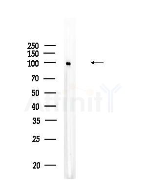 HACE1 Antibody - Western blot analysis of lysates from EC304 cells, using HACE1 Antibody at 1/1000 dilution.