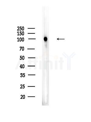 HACE1 Antibody - Western blot analysis of lysates from HUVEC cells, using HACE1 Antibody at 1/1000 dilution.