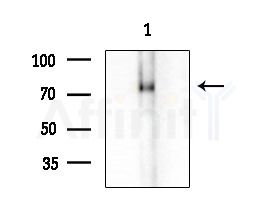 LRSAM1 Antibody - Western blot analysis of extracts from HUVEC cells, using LRSAM1 Antibody at 1/1000 dilution.