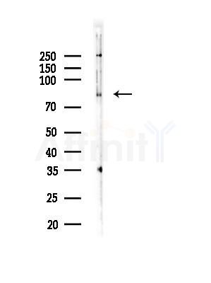 LRSAM1 Antibody - Western blot analysis of lysates from HUVEC cells, using LRSAM1 Antibody at 1/1000 dilution.