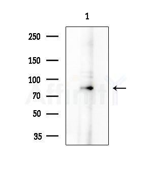 MARCH7 Antibody - Western blot analysis of extracts from B16F10-LUC cells(starvation treatment), using MARCH7 Antibody at 1/1000 dilution.