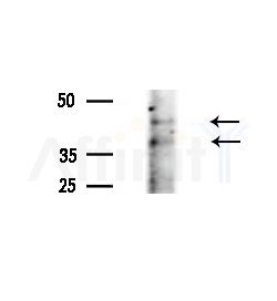 MARCH8 Antibody - Western blot analysis of extracts from B16F10-LUC cells(UV, 30min treatment), using MARCH8 Antibody at 1/1000 dilution.