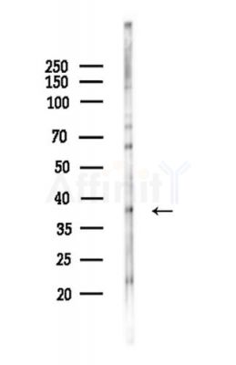MARCH9 Antibody - Western blot analysis of lysates from LoVo cells(heat-shock,45min treatment), using MARCH9 Antibody at 1/1000 dilution.
