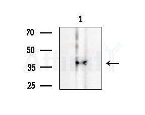RNF41 Antibody - Western blot analysis of extracts from HUVEC cells, using RNF41 Antibody at 1/1000 dilution.