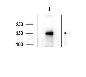 RNF123 Antibody - Western blot analysis of extracts from COLO205 cells(heat-shock treatment), using RNF123 Antibody at 1/1000 dilution.