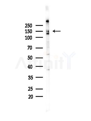 RNF123 Antibody - Western blot analysis of lysates from COLO205 cells(heat-shock,45min treatment), using RNF123 Antibody at 1/1000 dilution.
