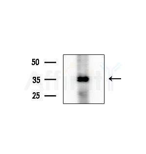 RNF167 Antibody - Western blot analysis of extracts from COLO205 cells(heat-shock treatment), using RNF167 Antibody at 1/1000 dilution.