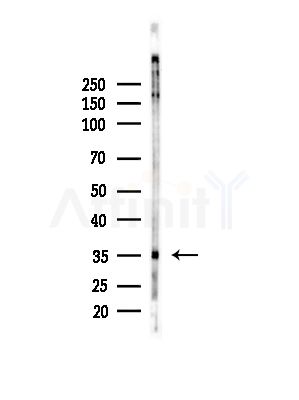 RNF167 Antibody - Western blot analysis of lysates from COLO205 cells(heat-shock,45min treatment), using RNF167 Antibody at 1/1000 dilution.
