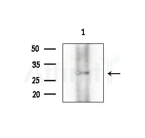 ZNRF1 Antibody - Western blot analysis of extracts from COLO205 cells(heat-shock treatment), using ZNRF1 Antibody at 1/1000 dilution.