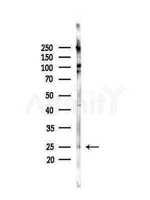 ZNRF1 Antibody - Western blot analysis of lysates from COLO205 cells(heat-shock,45min treatment), using ZNRF1 Antibody at 1/1000 dilution.