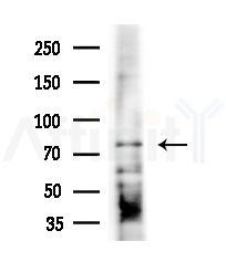 GFM1 Antibody - Western blot analysis of extracts from HepG2 cells(heat-shock,45min treatment), using GFM1 Antibody at 1/1000 dilution.
