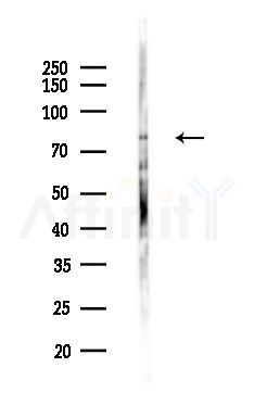 GFM1 Antibody - Western blot analysis of lysates from HepG2 cells(heat-shock,45min treatment), using GFM1 Antibody at 1/1000 dilution.
