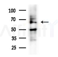 ELP3 Antibody - Western blot analysis of extracts from HepG2 cells(heat-shock,45min treatment), using ELP3 Antibody at 1/1000 dilution.