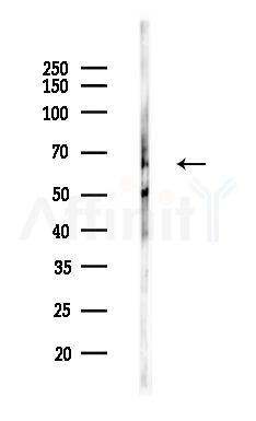ELP3 Antibody - Western blot analysis of lysates from HepG2 cells(heat-shock,45min treatment), using ELP3 Antibody at 1/1000 dilution.