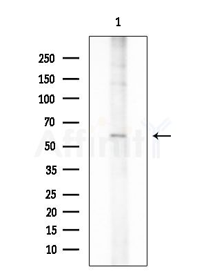 ENDOD1 Antibody - Western blot analysis of extracts from HUVEC cells, using ENDOD1 Antibody at 1/1000 dilution.