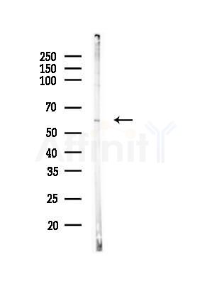 ENDOD1 Antibody - Western blot analysis of lysates from HUVEC cells, using ENDOD1 Antibody at 1/1000 dilution.
