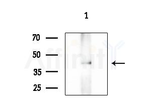 NEIL2 Antibody - Western blot analysis of extracts from 293 cells(starvation treatment), using NEIL2 Antibody at 1/1000 dilution.